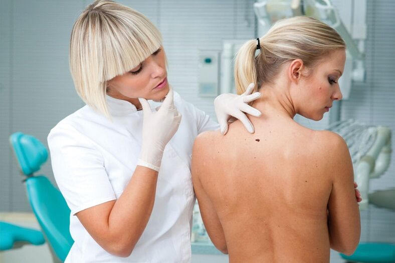 ¿Por qué aparecen papilomas en el cuerpo humano